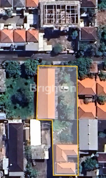 image PREMIUM LAND 1115M² DI RENON - LOKASI PRESTISIUS DENPASAR (4)