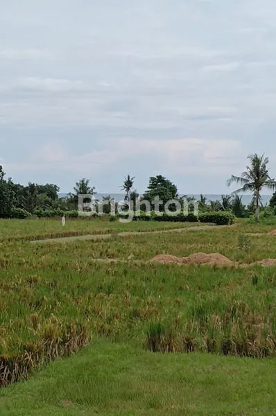 image PRIME BEACHFRONT DEVELOPMENT OPPORTUNITY – IDEAL FOR HOTEL & RESORT, BEACH CLUB, OR LUXURY VILLA ESTATE (6)