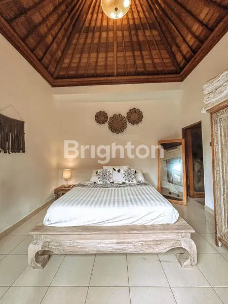 image VILLA MODERN 3 KAMAR DI BIDADARI SEMINYAK – LOKASI PREMIUM, FASILITAS LENGKAP (8)